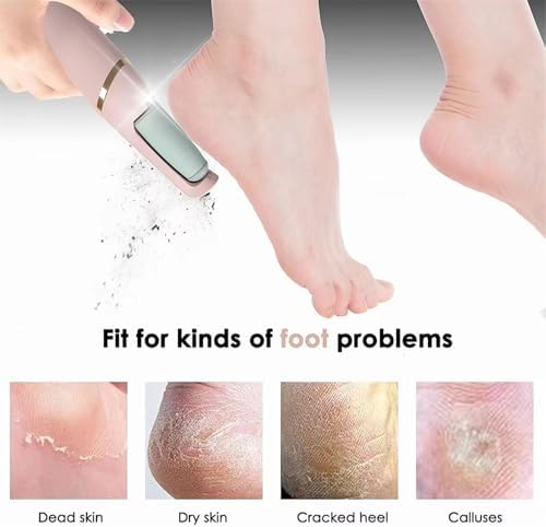 Sleek Feet Electric File™